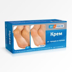 Крем для ног