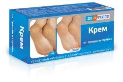 Крем для ног